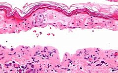 By Nephron - Own work, CC BY-SA 3.0, https://commons.wikimedia.org/w/index.php?curid=16874065