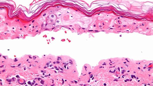 By Nephron - Own work, CC BY-SA 3.0, https://commons.wikimedia.org/w/index.php?curid=16874065