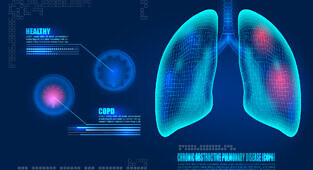 השפעות BR11595 - אנטגוניסט לרצפטור P2X4 - במודל אסטמה כרונית בשרקנים