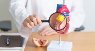 קוורצטין מקל על טרשת עורקים לאחר גיל המעבר באמצעות דיכוי פרופטוזיס בתאי האנדותל דרך ויסות מסלול KEAP1/NRF2/GPX4