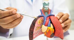 CircPTK2 מעודד שגשוג של סרטן ריאות מסוג תאים לא קטנים באמצעות דיכוי הזדקנות תאית, דרך ייצוב NFYA והעלאת ביטוי FOXM1